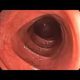 Healthy Colon